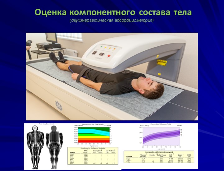 (двухэнергетическая абсорбциометрия) Оценка компонентного состава тела